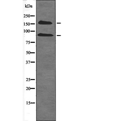 IGF1R (Phospho-Tyr980) Antibody