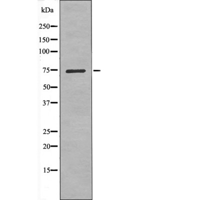 LIMK1 (Phospho-Ser323) Antibody