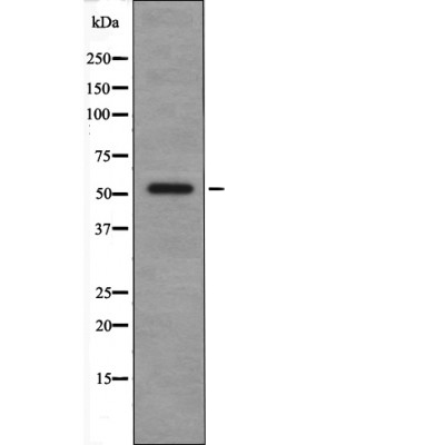 CSK (Phospho-Tyr304) Antibody