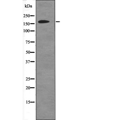 DAPK1 (Phospho-Ser736) Antibody