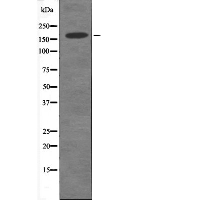 DAPK1 (Phospho-Ser289) Antibody