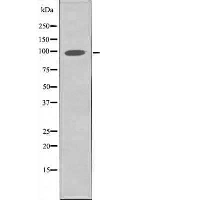 FGFR3 (Phospho-Tyr760) Antibody