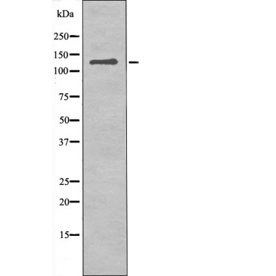 JAK3 (Phospho-Tyr981) Antibody