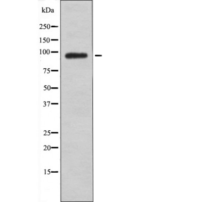 FGFR1/2/3/4 (Phospho-Tyr653+Tyr654) Antibody