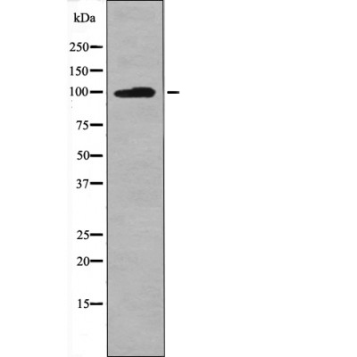 Leptin Receptor (Phospho-Tyr986) Antibody