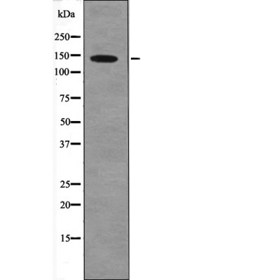 PDGFRa (Phospho-Tyr1018) Antibody