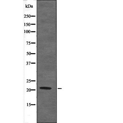Claudin 4 (Phospho-Tyr208) Antibody