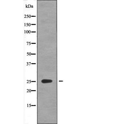 GAIP (Phospho-Ser151) Antibody
