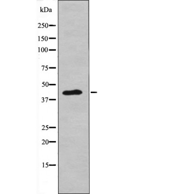 NDRG2 (Phospho-Thr348) Antibody