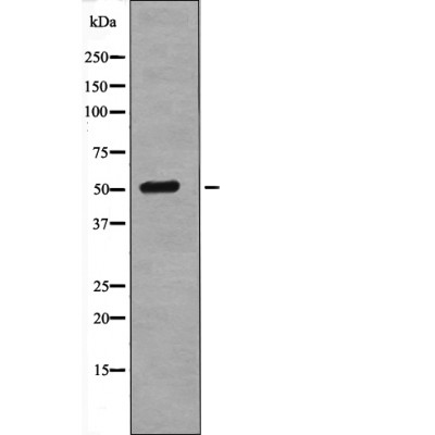 Tel (Phospho-Ser257) Antibody