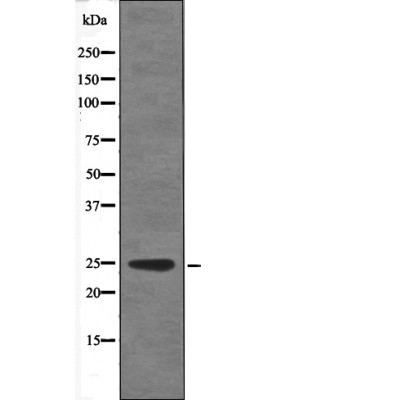 VHL (Phospho-Ser68) Antibody