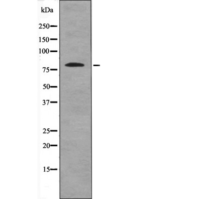 BTK (Phospho-Ser179) Antibody