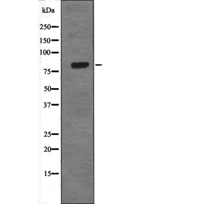 GRK1/2 (Phospho-Tyr13) Antibody