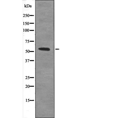IRF5 (Phospho-Ser437) Antibody