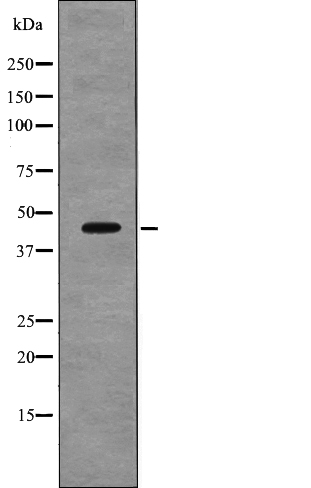 VASP (Phospho-Thr278) Antibody