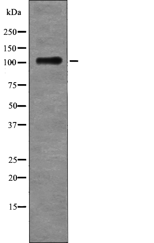 EPHB4 (Phospho-Tyr987) Antibody