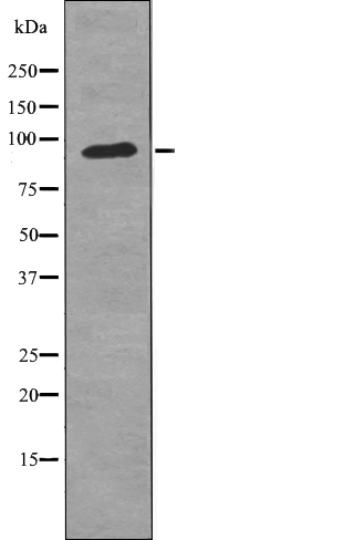 FGFR3 (Phospho-Tyr724) Antibody