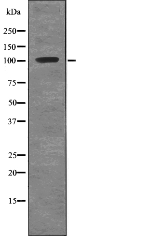 ROR1 (Phospho-Tyr786) Antibody