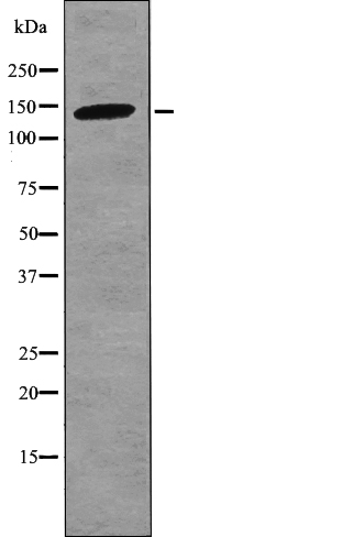 Bamacan (Phospho-Ser1067) Antibody