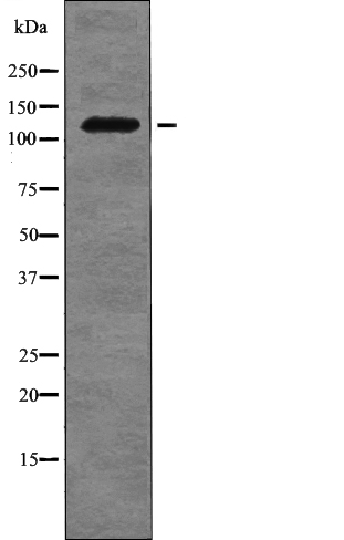 FLT3 (Phospho-Tyr955) Antibody