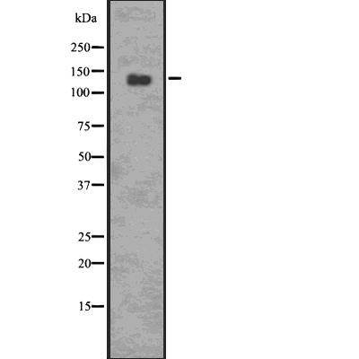 p-PERK (Phospho-Thr 981) Antibody