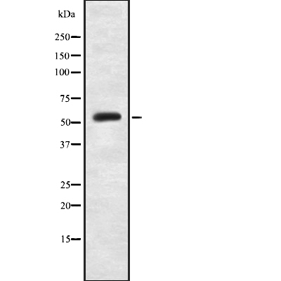 PKM2(Phospho-Ser37)  Antibody