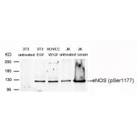 eNOS(Phospho-Ser1177) Antibody