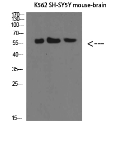 E-Selectin Polyclonal Antibody