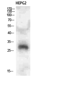 CLECSF6 Polyclonal Antibody