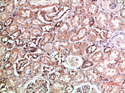 CD158f1/2 Polyclonal Antibody