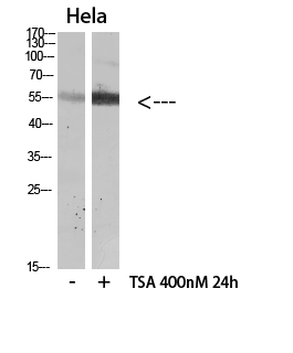 HNF-4α (Acetyl Lys106) Polyclonal Antibody