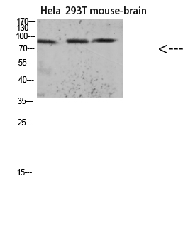 Tau (Acetyl Lys174) Polyclonal Antibody