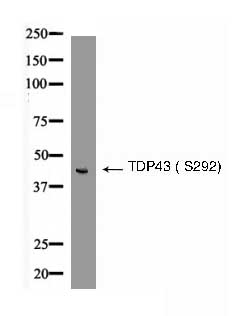 TDP43 (Phospho- Ser292) Antibody