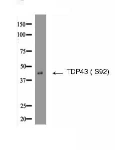 TDP43 (Phospho- Ser92) Antibody