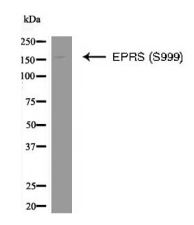 EPRS (Phospho-Ser999) Antibody