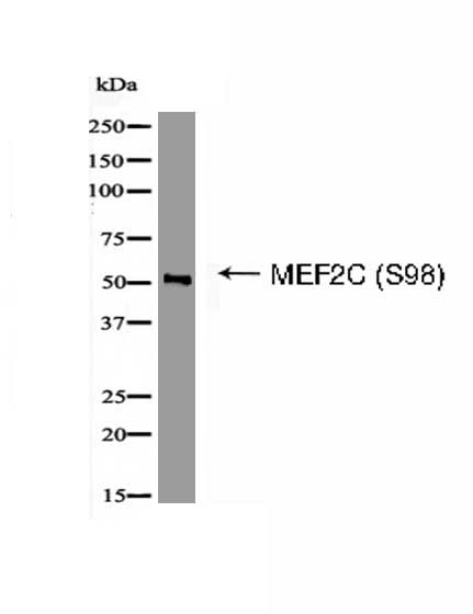MEF2C (Phospho-Ser98) Antibody