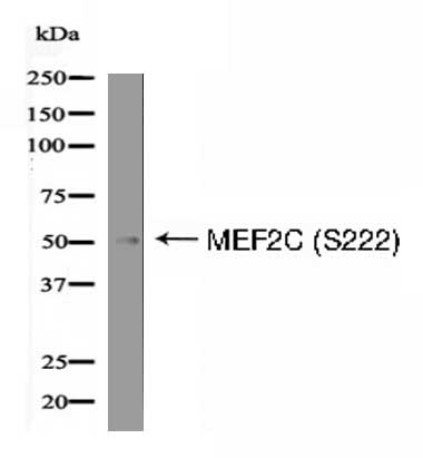 MEF2C (Phospho-Ser222) Antibody