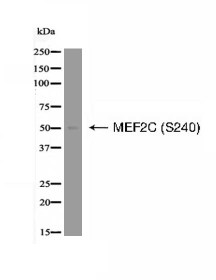MEF2C (Phospho-Ser240) Antibody