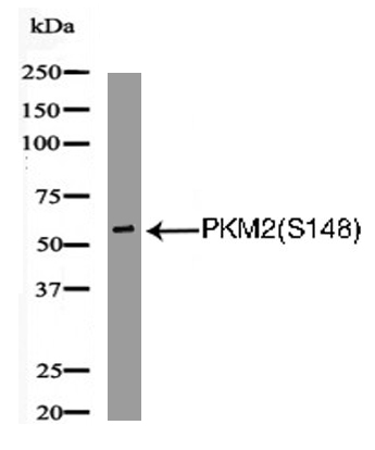 PKM2(Phospho-Ser148) Antibody
