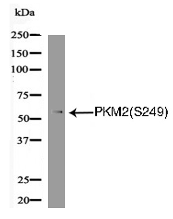 PKM2(Phospho-Ser249) Antibody