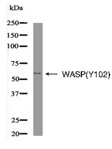 WASP(Phospho-Tyr102) Antibody