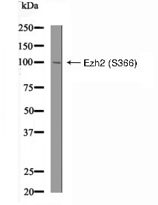 Ezh2 (Phospho-Ser366) Antibody