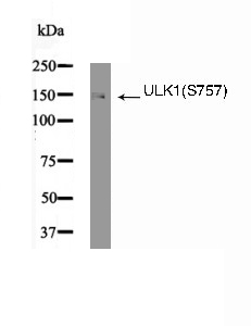 ULK1(Phospho-Ser757) Antibody