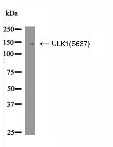 ULK1(Phospho-Ser637) Antibody