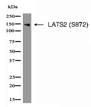 LATS2 (Phospho-Ser872) Antibody