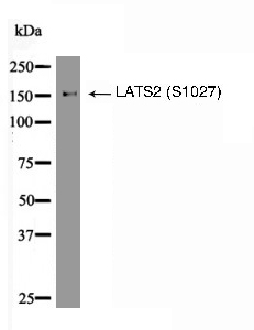 LATS2 (Phospho-Ser1027) Antibody