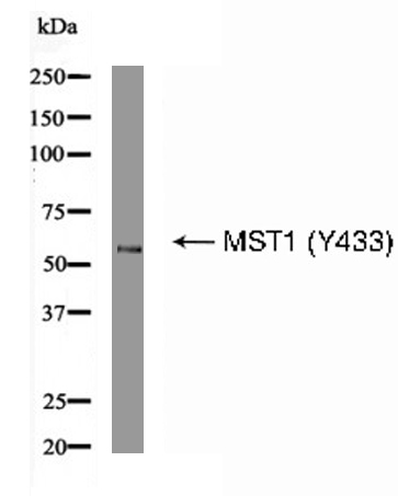 MST1 (Phospho-Tyr433) Antibody