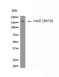 her2 (Phospho-Ser410) Antibody