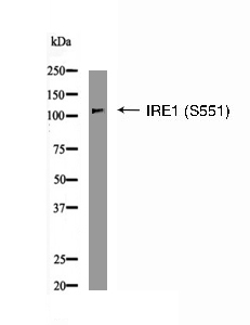 IRE1 (Phospho-Ser551) Antibody