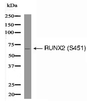 RUNX2 (Phospho-Ser451) Antibody